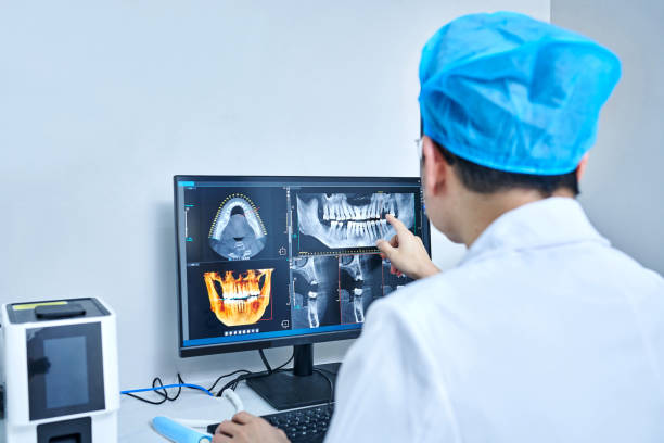 Best Emergency Wisdom Tooth Extraction in Cedar Bluff, VA