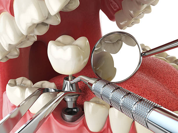 Best Urgent Dental Care for Toothaches in Cedar Bluff, VA